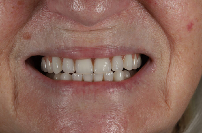 After - Cheadle Hulme Dental