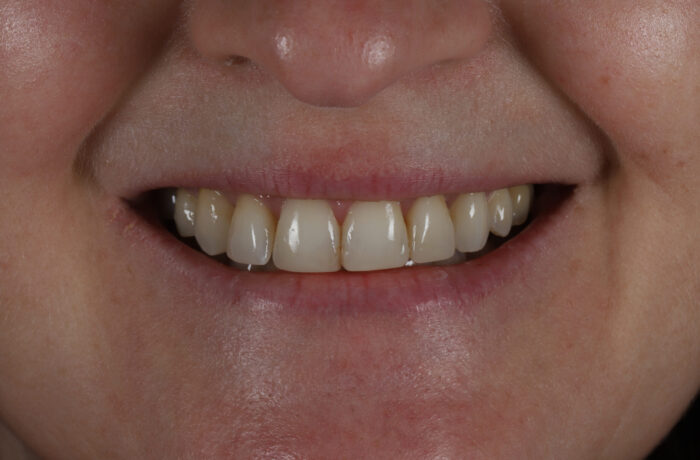 After - Cheadle Hulme Dental