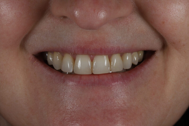 After - Cheadle Hulme Dental