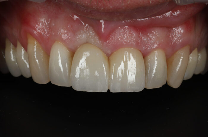 After - Cheadle Hulme Dental