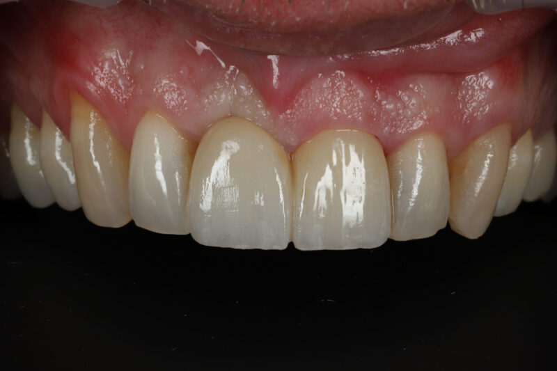 After - Cheadle Hulme Dental