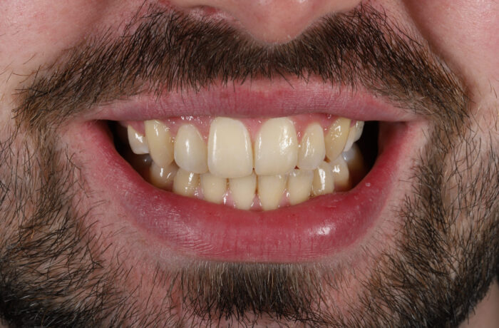 After - Cheadle Hulme Dental