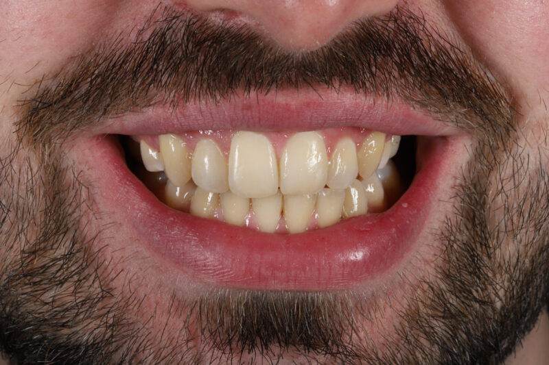 After - Cheadle Hulme Dental