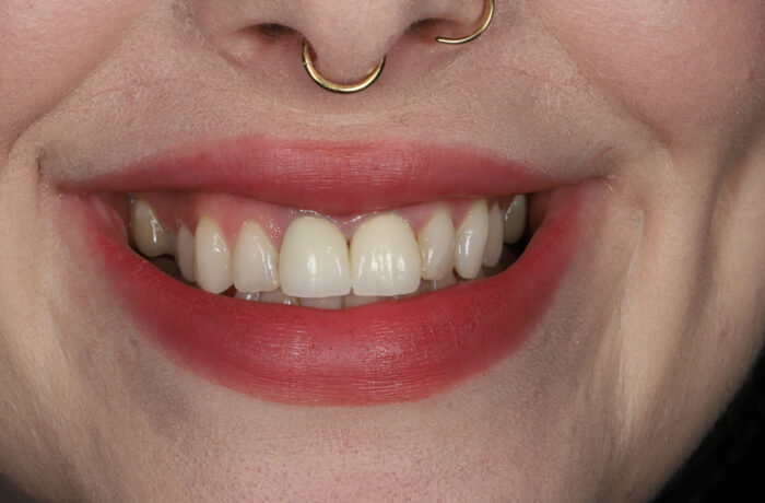 After - Cheadle Hulme Dental