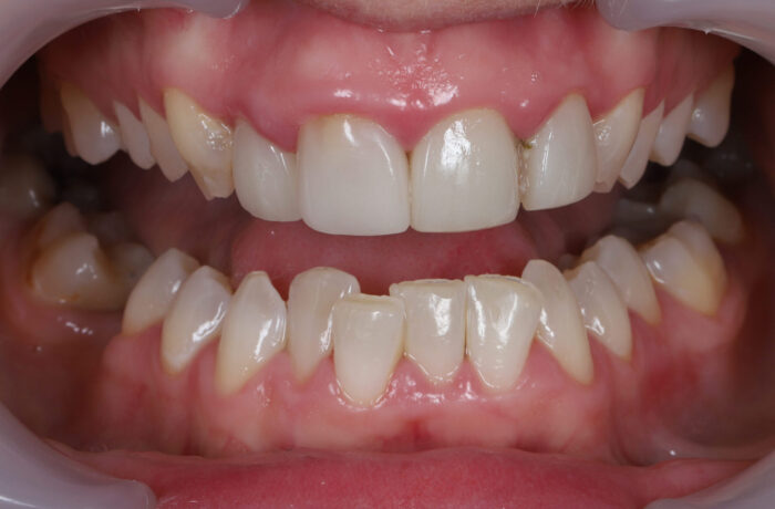 Before - Cheadle Hulme Dental