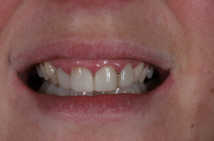 Before - Cheadle Hulme Dental