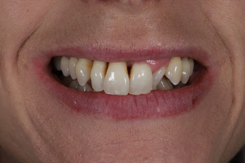 Before - Cheadle Hulme Dental