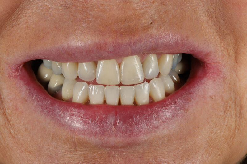 After - Cheadle Hulme Dental