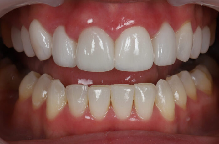 After - Cheadle Hulme Dental