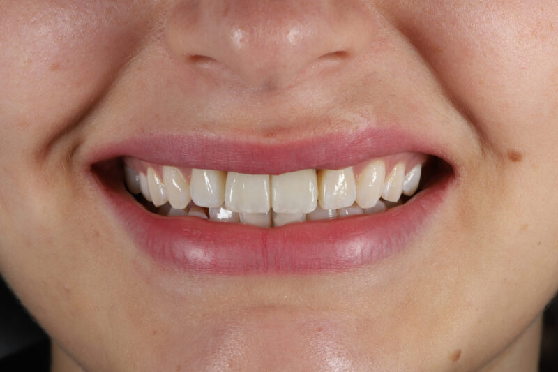 After - Cheadle Hulme Dental