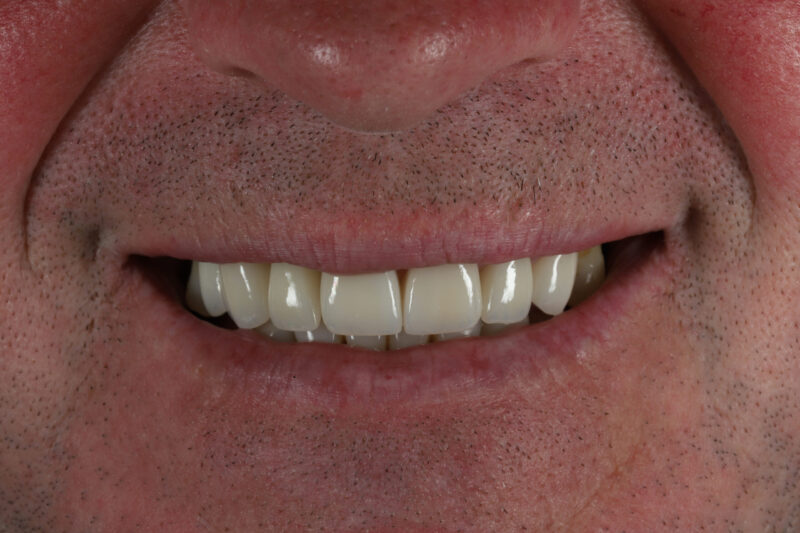 After - Cheadle Hulme Dental