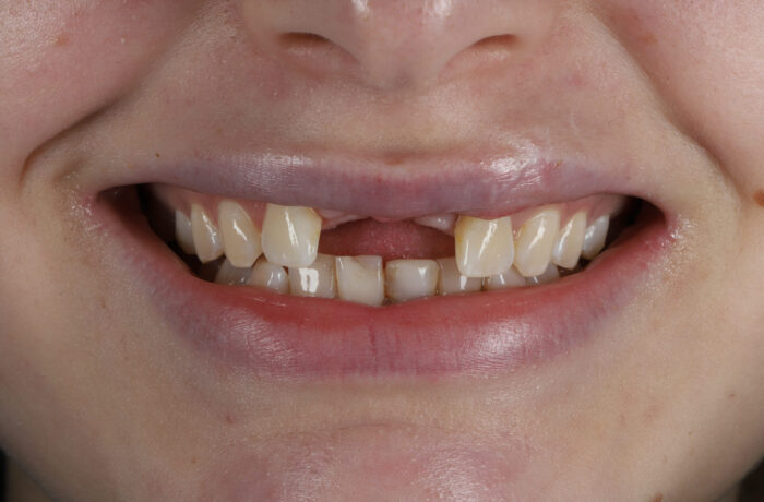 Before - Cheadle Hulme Dental